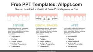 Dental Braces Course PowerPoint Diagram