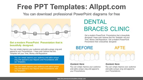 Dental Braces PowerPoint Diagram